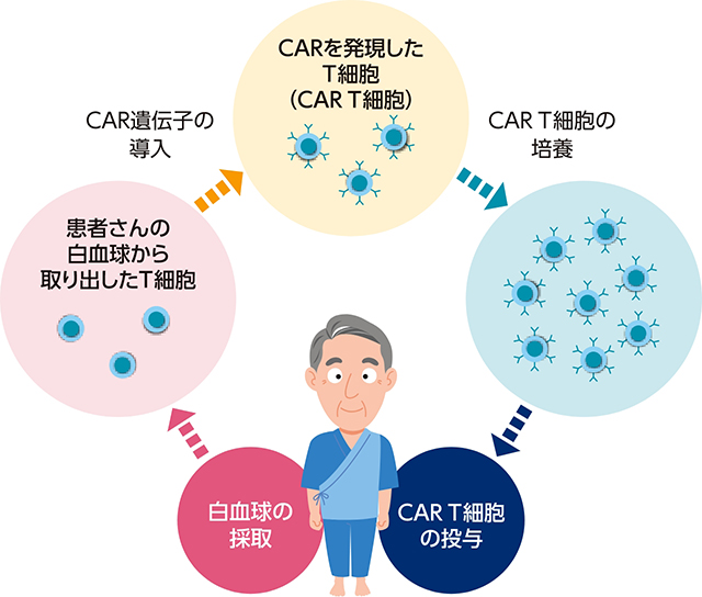 CAR T 「CAR」はキメラ抗原需要体、「T」はT細胞を示します。キメラ抗原受容体とは、標的とするがん細胞の表面にある抗原に結合するように人口的に組み換えられた受容体です。
